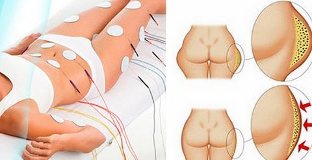 benefici dei miostimolanti